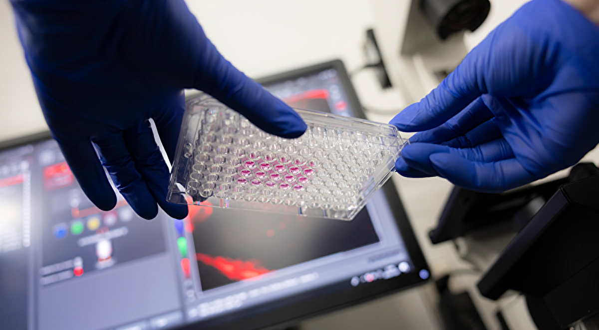 Understanding the Mechanisms of Rare and Intractable Diseases for Advanced Diagnosis and Treatments