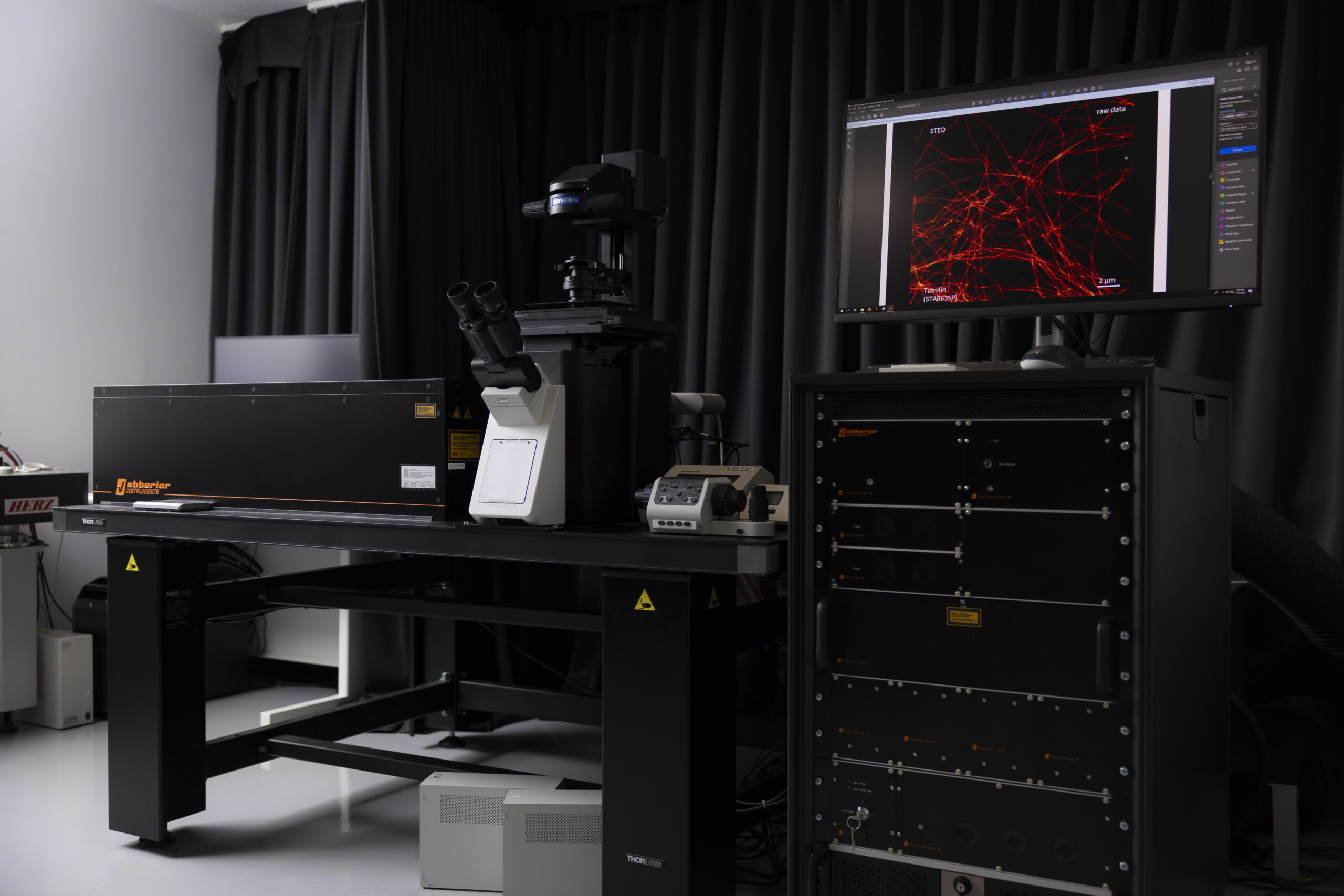 Exploring the fundamental question: <br>“What is aging?” to overcome age-related diseases