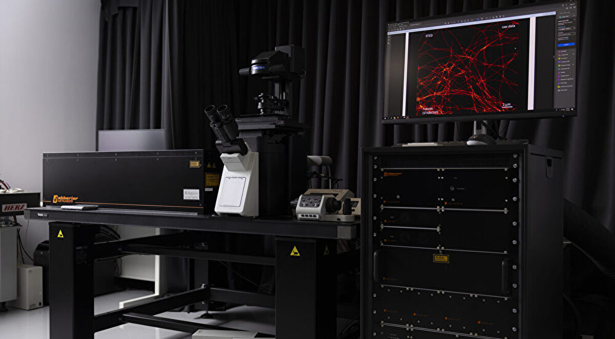 Exploring the fundamental question: <br>“What is aging?” to overcome age-related diseases